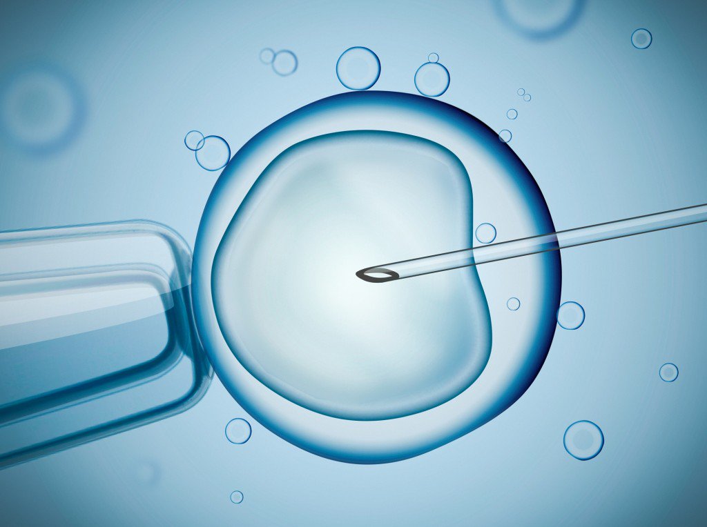 Phương pháp thụ tinh trong ống nghiệm IVF