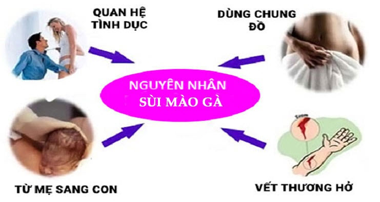 Phòng Khám Và Chữa Bệnh Sủi Mào Gà Ở TP Quỳnh Lưu‎‎‎‎ ‎, Nghệ An Uy Tín & Bí Mật